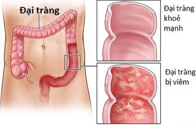 Tinh-Bot-Khang-Sieu-Thuc-Pham-Cho-He-Tieu-Hoa-Khoe-Manh-5