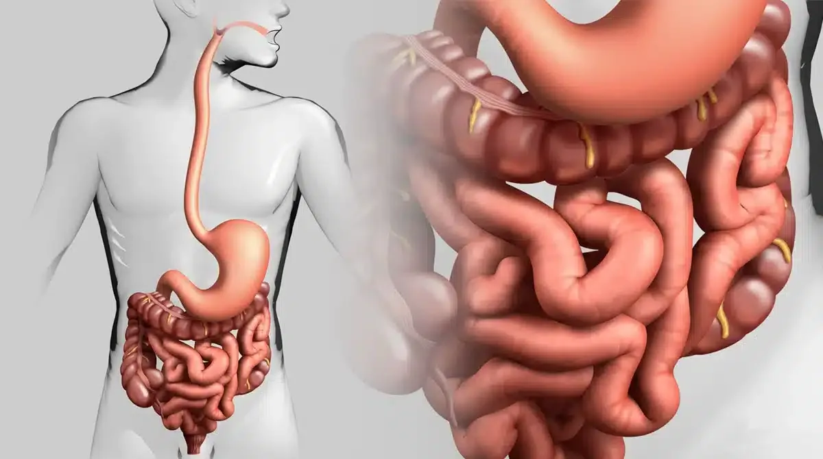 Viêm ruột là một bệnh lý có đặc điểm chính là sự viêm nhiễm xảy ra ở niêm mạc ruột. Viêm ruột là một bệnh lý có đặc điểm chính là sự viêm nhiễm xảy ra ở niêm mạc ruột.
