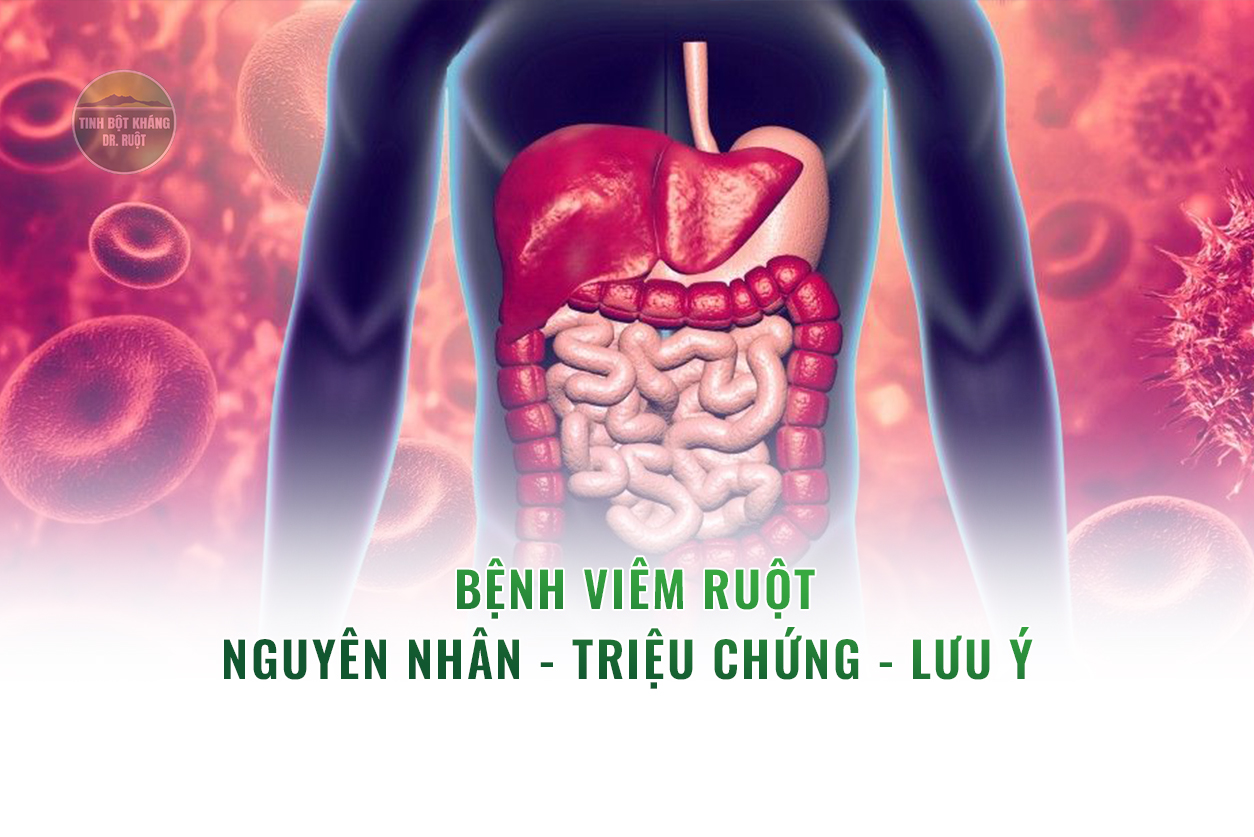 Bệnh-viêm-ruột---Nguyên-nhân---Triệu-chứng---Lưu-ý