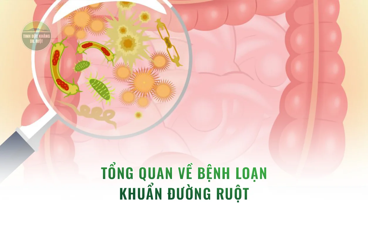 Tổng quan về bệnh loạn khuẩn đường ruột